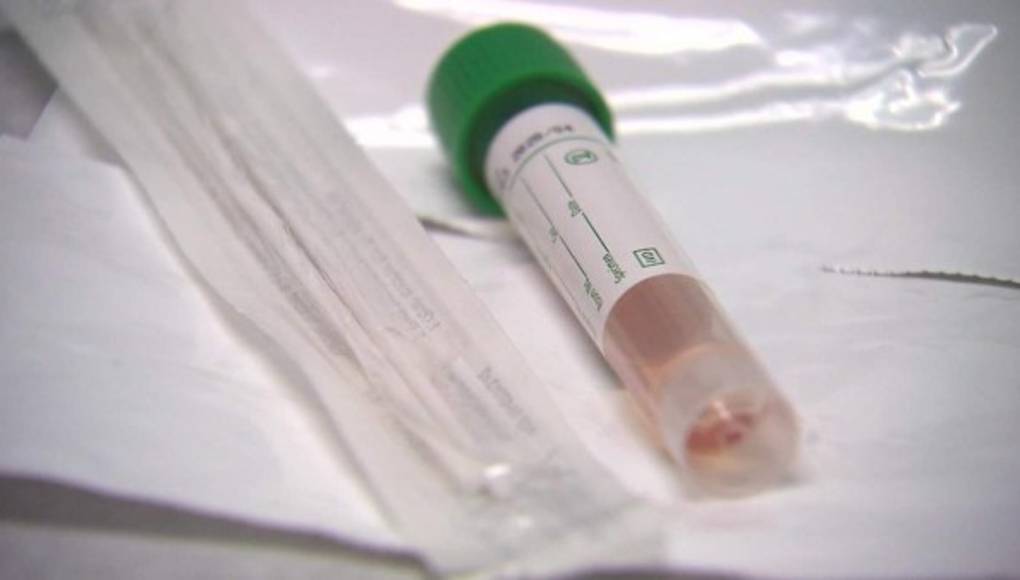 La FDA advierte sobre los falsos kits de pruebas para el COVID-19