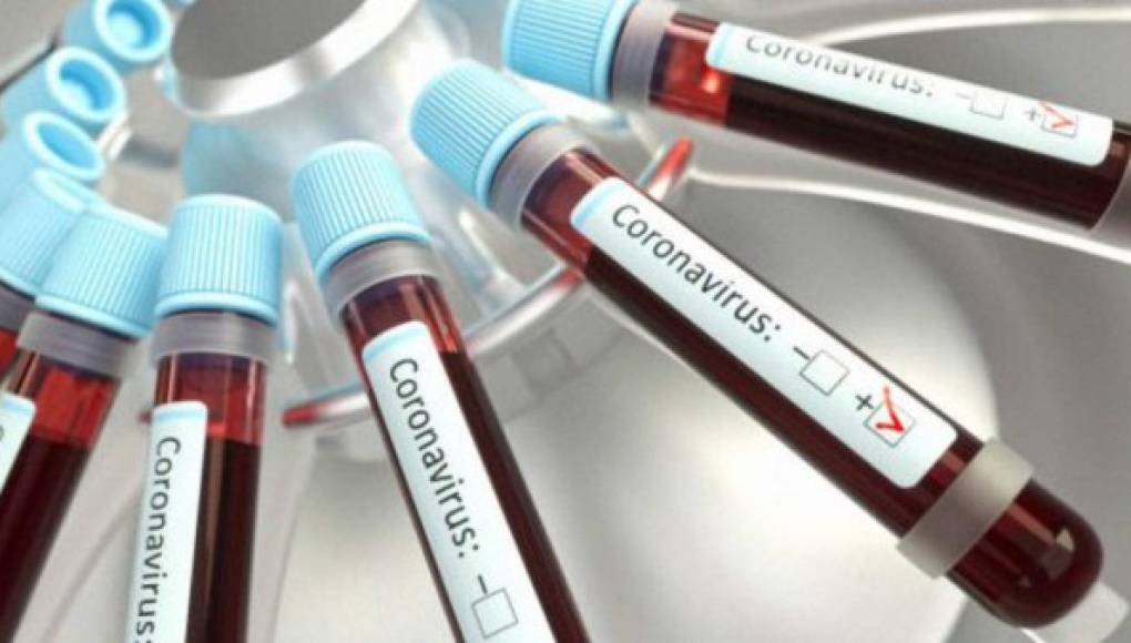 Un 5% de los españoles desarrolló anticuerpos al coronavirus