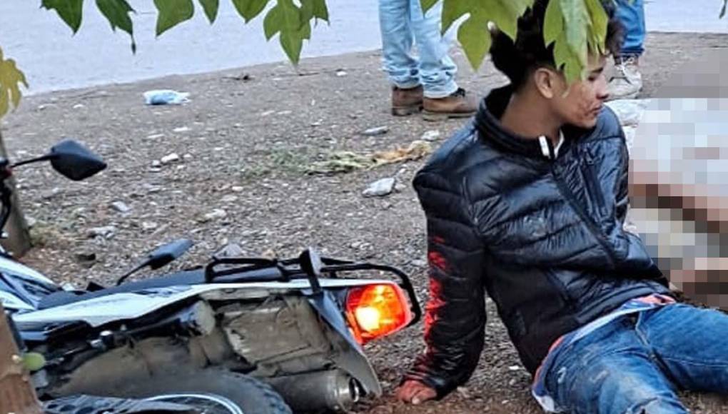 Motociclista pierde la vida tras impactar con un poste del fluido eléctrico