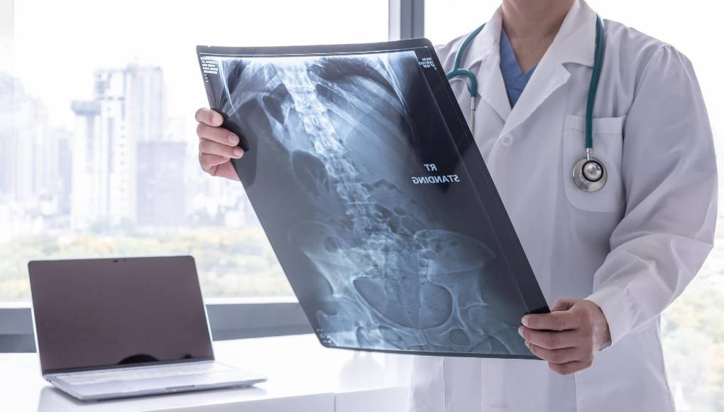 ¿Una prueba de heces podría ayudar a detectar el cáncer de páncreas?