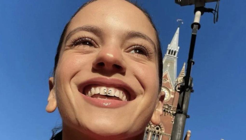 La joyería dental, tendencia del 2010 que ha regresado