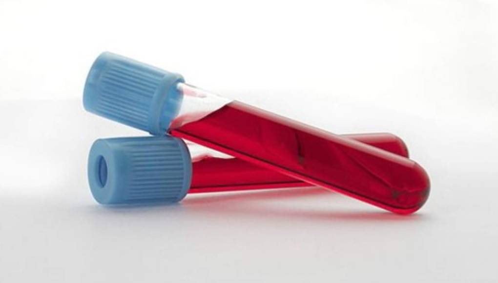 Crean un tatuaje biomédico que detecta altos niveles de calcio en la sangre