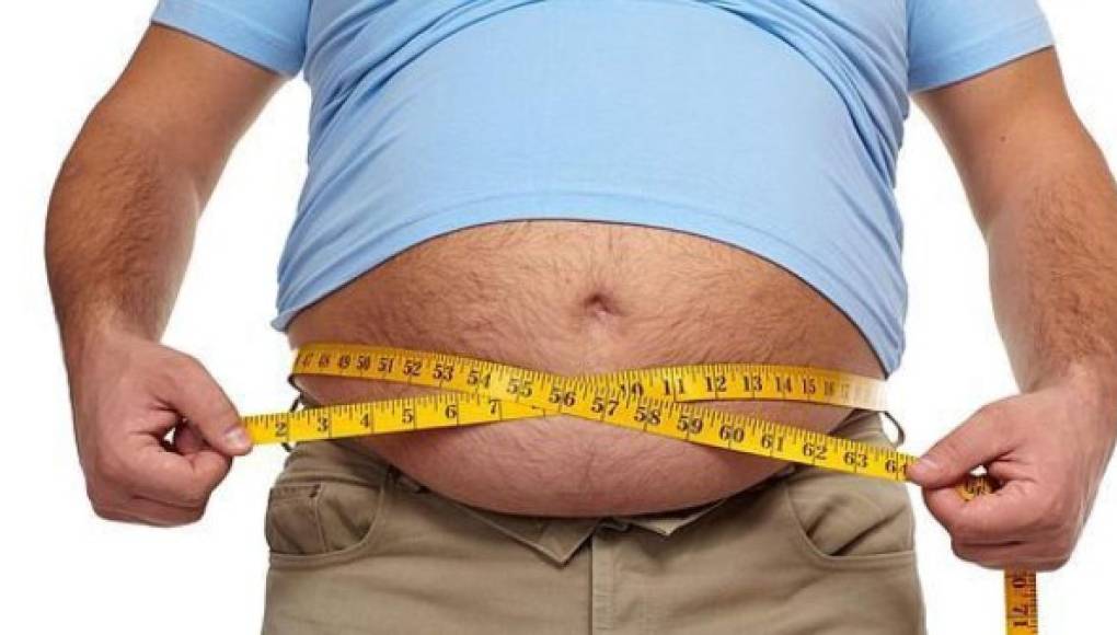 Obesidad, factor de riesgo para desarrollar cirrosis hepática