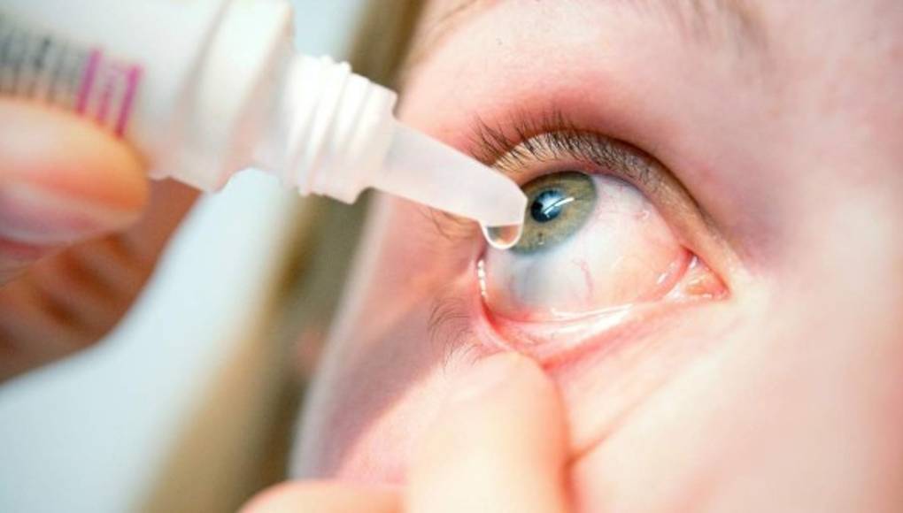 Una buena higiene es la clave para prevenir la conjutivitis