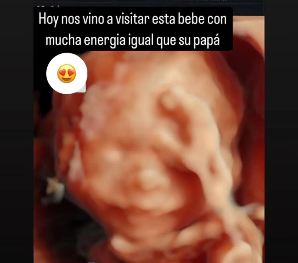 Por ahora es muy notable el crecimiento de la hija de Shin Fujiyama, su mamá en redes sociales ha mencionado que está muy bien y con mucha energía como su papá. 