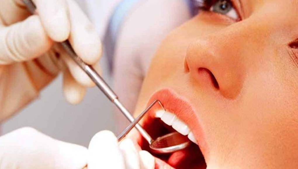 Muelas del juicio, las más propensas a infecciones