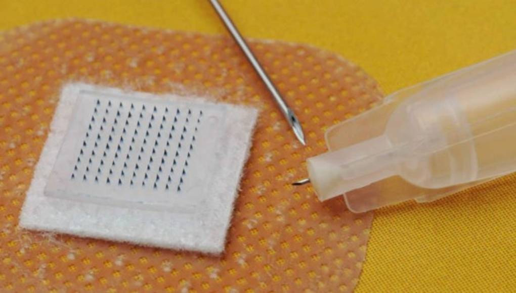 La nueva vacuna contra el sarampión se aplicará con un parche en la piel