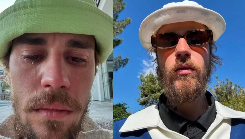 Justin Bieber desató la preocupación de sus fans en redes sociales tras postear una serie de fotografías sin contexto, llamando la atención por dos de ellas donde aparece con lágrimas y notablemente afectado emocionalmente.