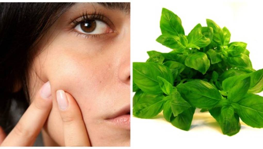 Albahaca para el acné