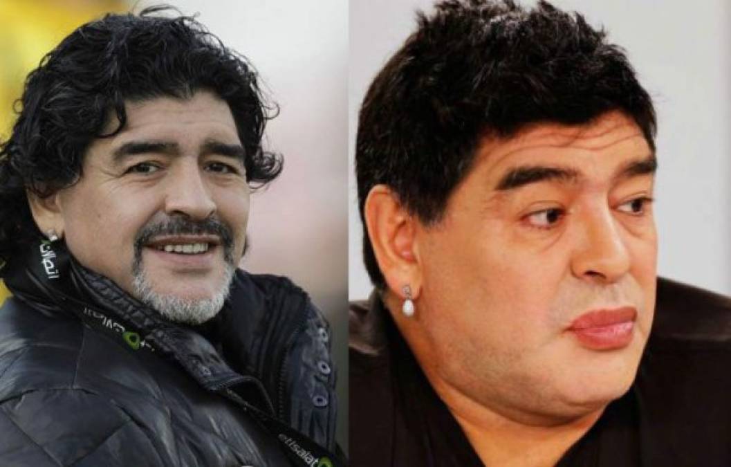 Diego Maradona se sometió a una operación para ponerse un bypass gástrico y solucionar así su problemas de sobrepeso. Sin embargo, esa no es la única vez que el argentino ha pasado por el quirófano para mejorar su aspecto.