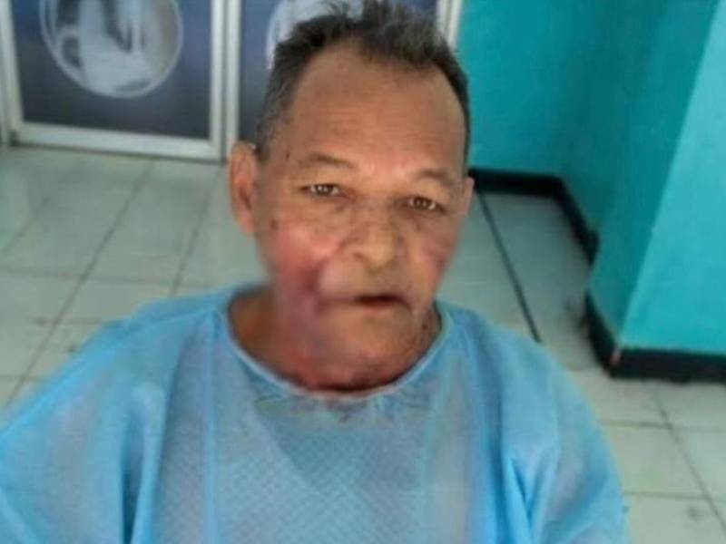 César Chávez fue llevado al hospital y tras atender su heridas fue dado de alta.