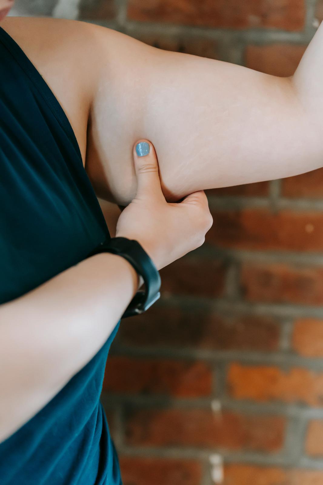 ¿Belleza sin límites? Usan grasa de donantes fallecidos para esculpir cuerpos