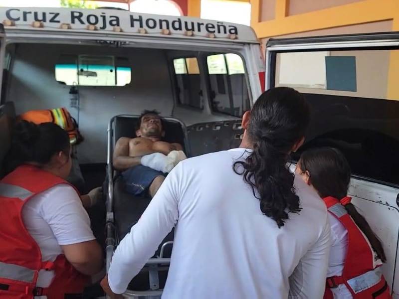 El trabajador de una cohetería artesanal sufrió lesiones graves al explotarle material para hacer cohetes en Nueva Arcadia, Copán.