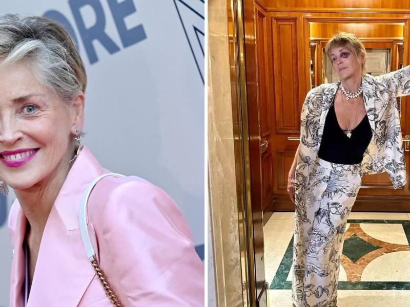 Sharon Stone publicó una fotografía en su Instagram, captada en un elevador, donde se le ve el fuerte hematoma que sufrió en el rostro.