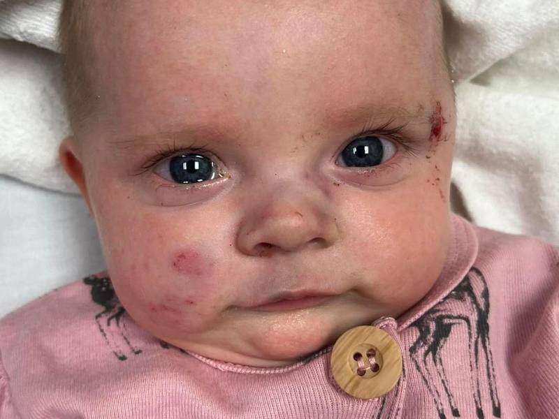 Oaklynn Koon, de dos meses de edad, falleció el domingo a causa de las heridas sufridas tras el azote de un gigantesco tornado en Kentucky.