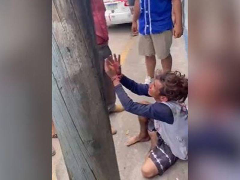 Golpean hasta las lágrimas a ladrón en Choluteca: “No tengo culpa, perro”