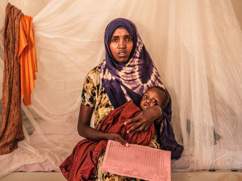 Crisis: la desnutrición infantil desborda los centros en Somalia