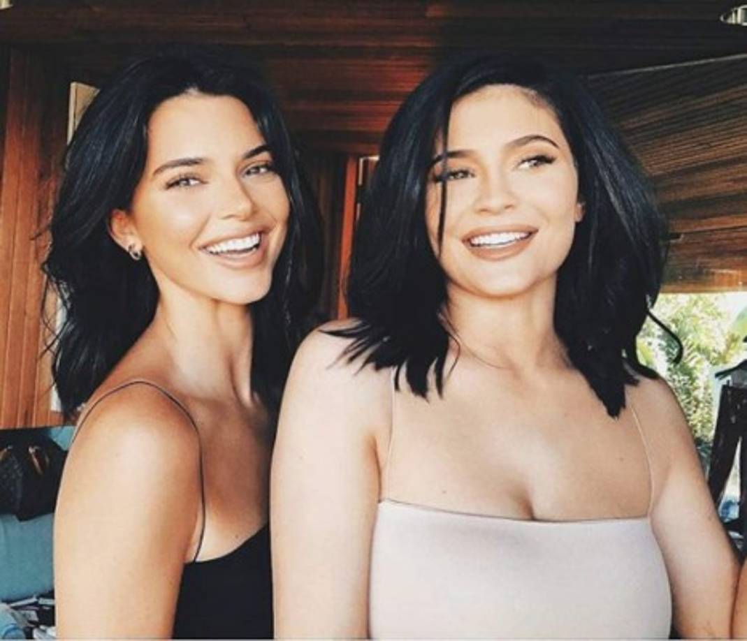 Actualmente, el ácido hialurónico es la sustancia más común que los médicos utilizan para generar volumen en distintas partes del rostro, por lo que es muy probable ese fue el tratamiento al que la joven empresaria se sometió.