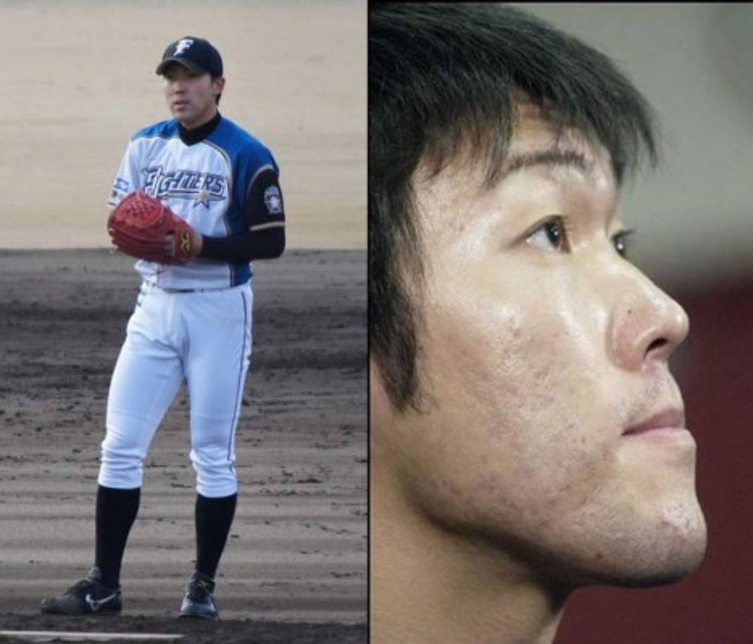 El pitcher japonés Kazuhito Tadano reconoció que actuó en una película de porno gay, lo que creó todo un escándalo en Japón. Actualmente juega para el equipo Hokkaido Nippon-Ham Fighters de su país.
