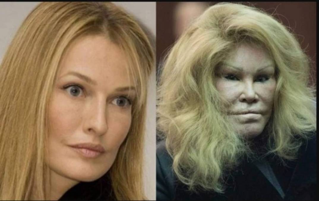 Jocelyn Wildenstein<br/><br/>Según algunos cercanos a ella, se sometió a más de 30 cirugías para verse como un gato pues su exesposo estaba obsesionado con estos animales.