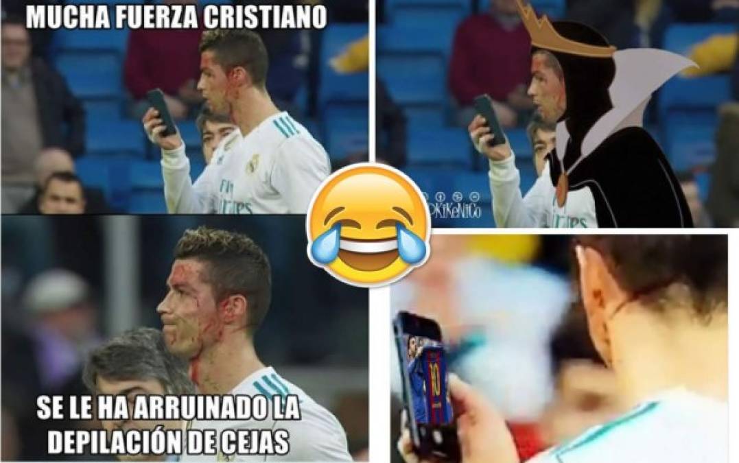 Los memes con la fotografía del delantero del Real Madrid, Cristiano Ronaldo, comprobando mediante un celular el estado de la herida en la ceja que se produjo ante el Deportivo La Coruña no se hicieron esperar.