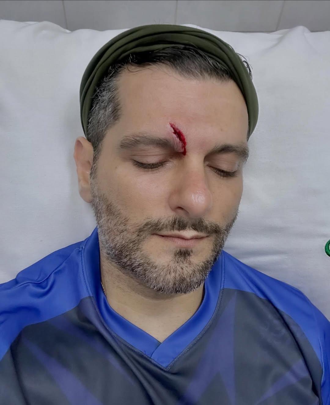 Samy Mustaklem sufre accidente de pádel y termina en emergencia