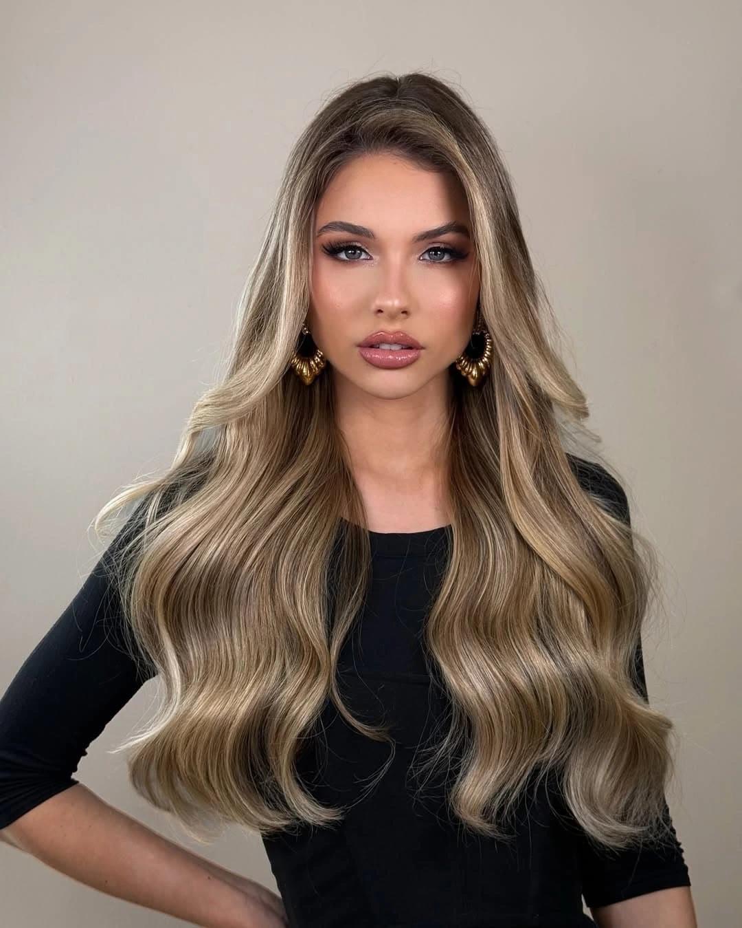 Miss Argentina 2025, Aldana Masset, revela que padece alopecia