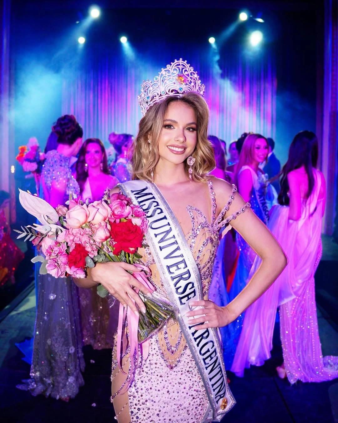 Miss Argentina 2025, Aldana Masset, revela que padece alopecia