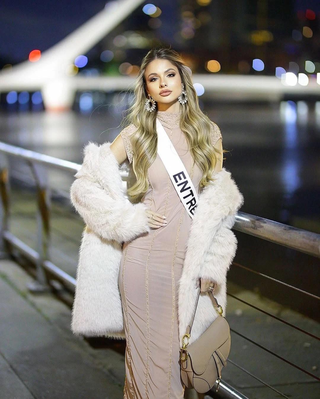 Miss Argentina 2025, Aldana Masset, revela que padece alopecia