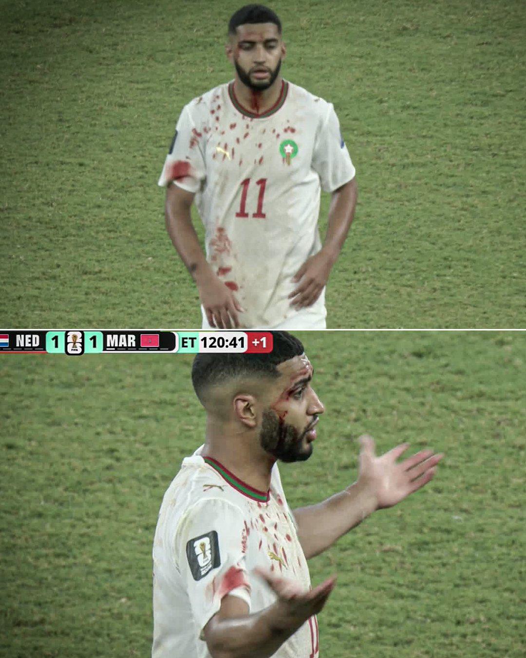 Países Bajos destrozado, euforia de Marruecos, figura llora y jugadores con sangre