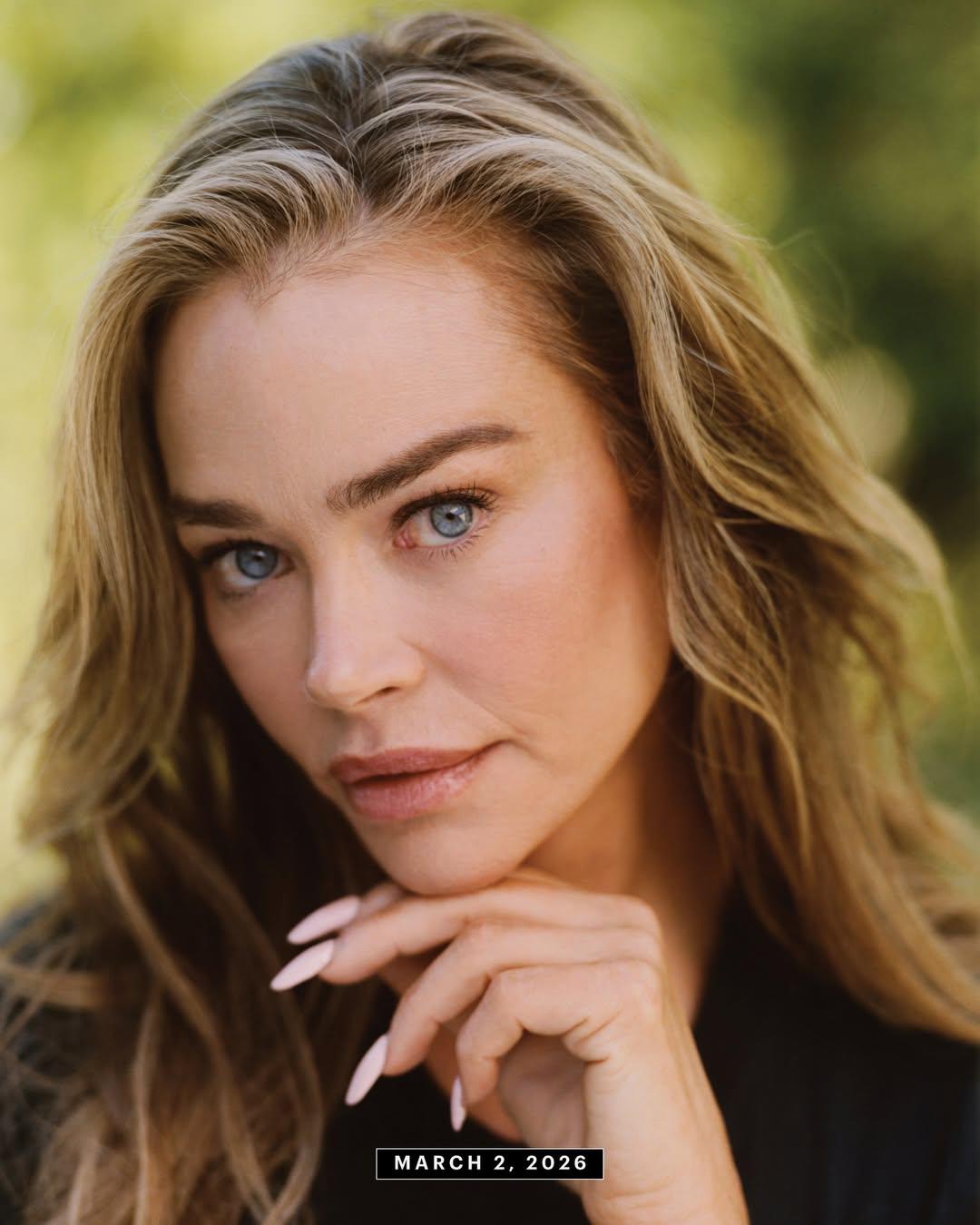 Denise Richards revela detalles de su lifting facial a los 54 años