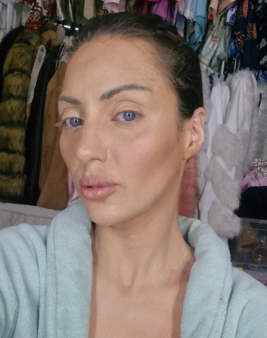 Revelan causa de fallecimiento de la Barbie humana