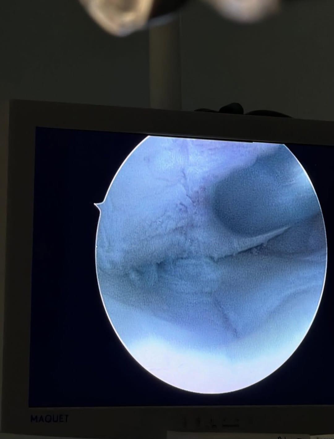 Así se encuentra Shin Fujiyama luego de su cirugía invasiva