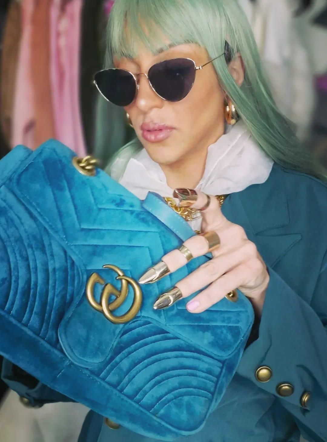 Revelan causa de fallecimiento de la Barbie humana