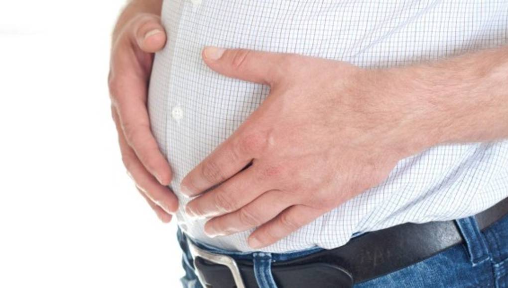 El sobrepeso se asocia con el Alzheimer