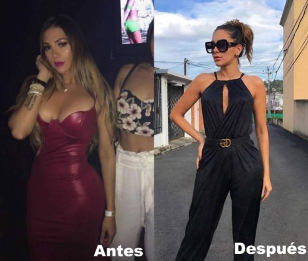 La cirugía de emergencia resultó exitosa para la joven, quien resultó ser la imagen de la clínica donde se realizó el procedimiento. <br/>