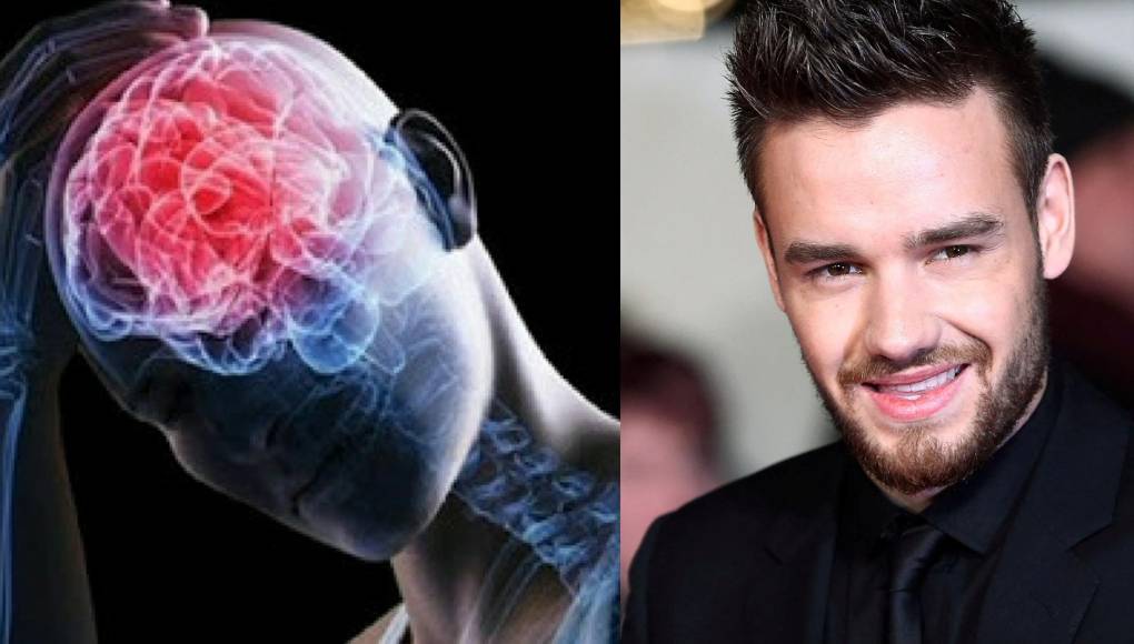 ¿Qué es un politraumatismo?, la causa de muerte de Liam Payne