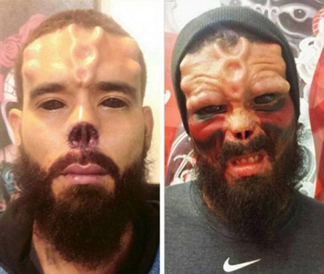 Damon,padre de familia, antes de realizar en su cara todas las modificaciones posibles para parecerse a Cráneo Rojo, pasó por pruebas psicológicas para determinar su estado de salud mental.