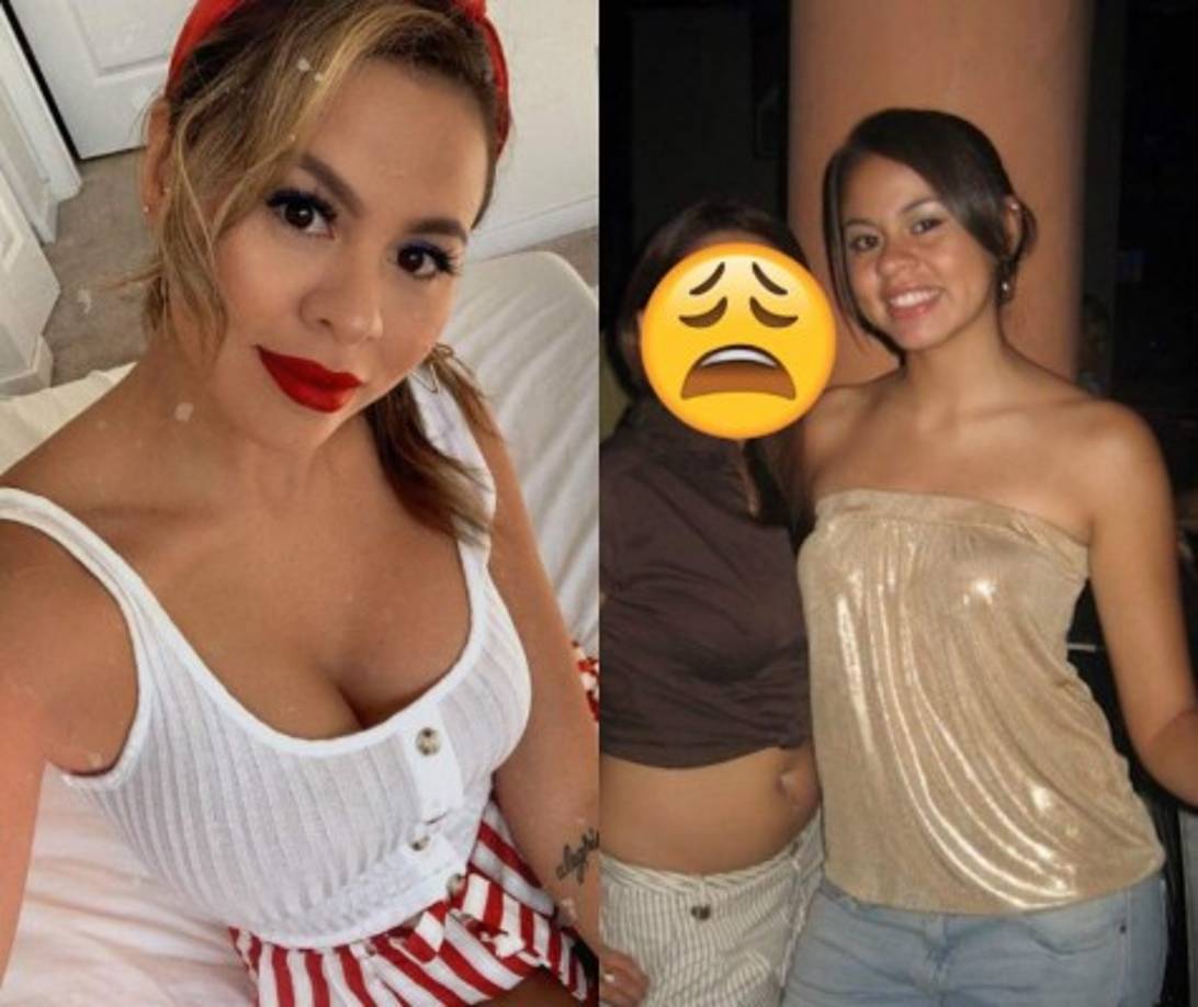 La hondureña no ha negado sus procedimientos. También se ha inyectado botox para reducir las arrugas de su frente.