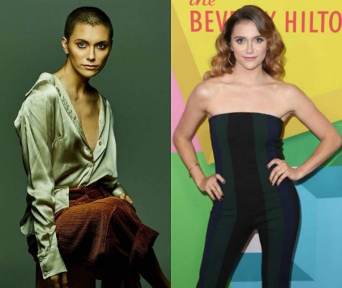 Stoner se afeitó el cabello durante la grabación de su video 'Stripped bare'.<br/><br/>'Afeitarme la cabeza es un acto de salud mental y confianza, no autodestrucción', dijo a People. “No puedo decirte cuántas creencias, opiniones e inseguridades cayeron al suelo con cada mechón de cabello, y los dejo allí. Estoy perdiendo una era y creciendo como un nuevo ser'.