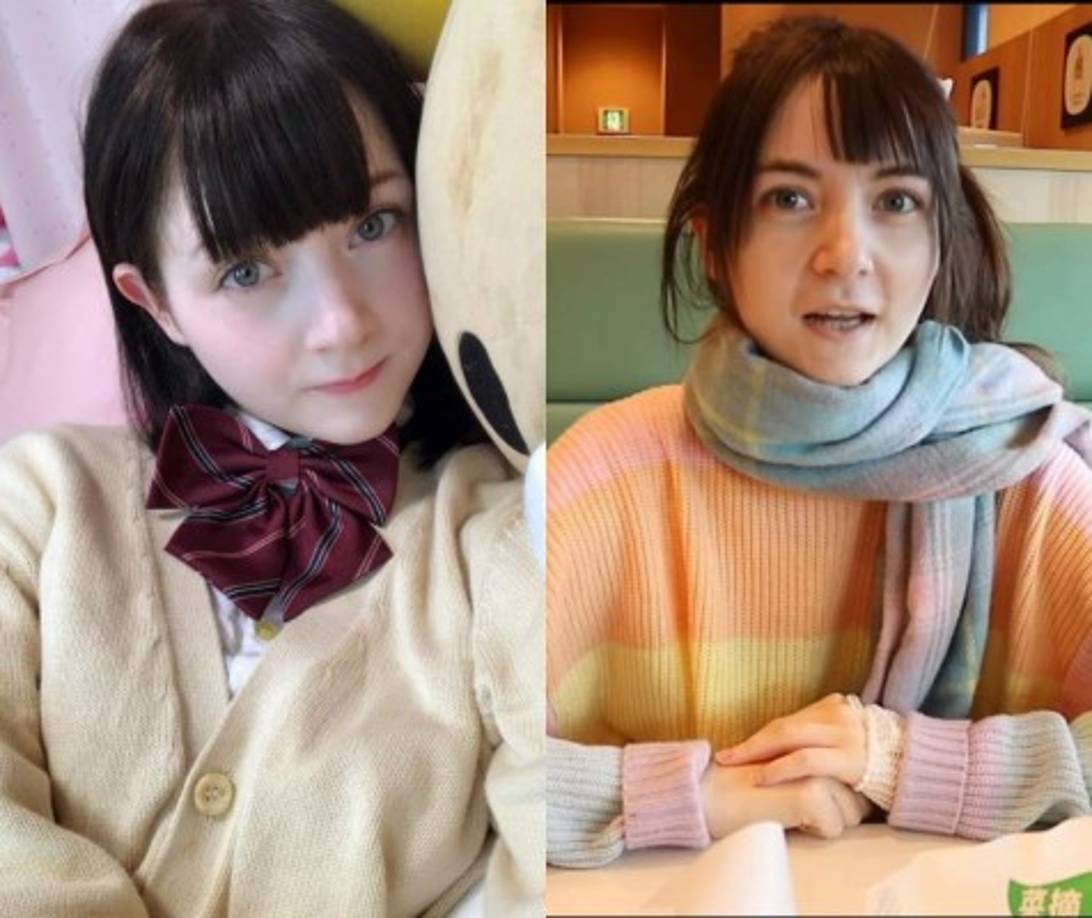 'Me dijeron que estaba en riesgo vital y que debían operarme de urgencia. Fue horrible y extremadamente doloroso', admitió.