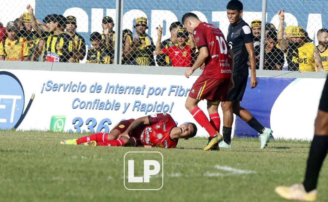 El defensa tico Heyreel Saravia, del Real España, sufrió una terrible lesión en el duelo ante Honduras Progreso.