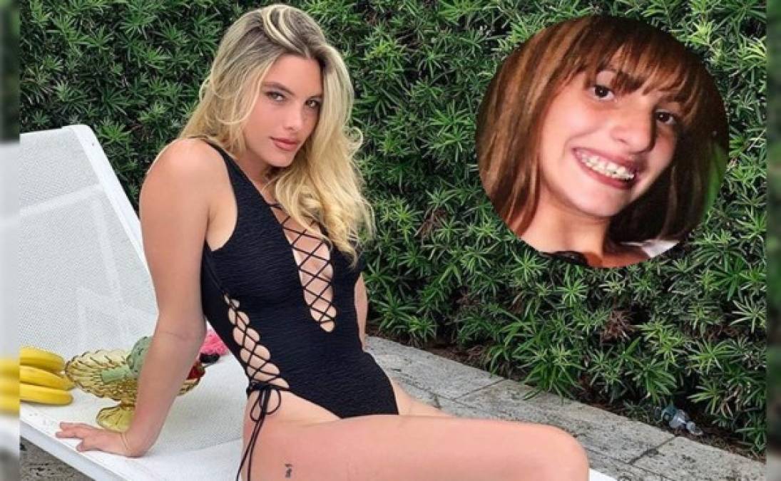 El cirujano plástico Dr. Kassir publicó varias fotos del antes y después de Lele Pons en el marco del 24 cumpleaños de la famosa venezolana.