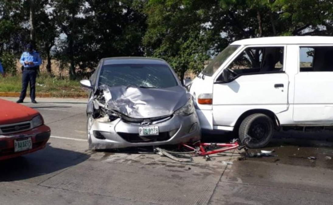 Pastor Gámez, un ciudadano que practicaba ciclismo, fue atropellado en un accidente ocurrido en la carretera entre los municipios de San Manuel y La Lima, departamento de Cortés. El joven resultó con heridas de gravedad y el femur fracturado.