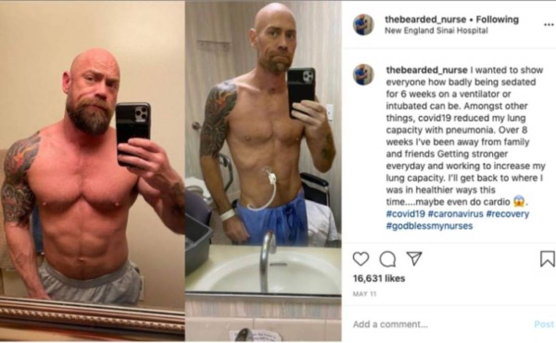 Tras recuperarse, Mike compartió una imagen en Instagram de su dramática transformación, que se viralizó en redes sociales.'No importa si eres joven o viejo, si tienes condiciones preexistentes o no. El coronavirus puede afectarte', afirmó Mike al portal Buzzfeed.