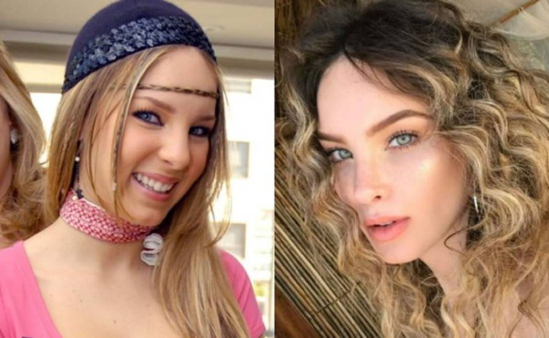 Aunque la actriz y cantante lo niegue, el cambio en ella ha sido casi tan evidente como el de Eiza González o Kylie Jenner. Es imposible obviarlo, la estrella de 'Sapito' se ha realizado múltiples retoques estéticos para mejorar su aspecto.