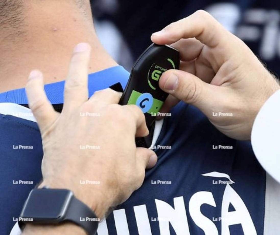 Una imagen más cerca del GPS que se le colocó a Harold Fonseca.