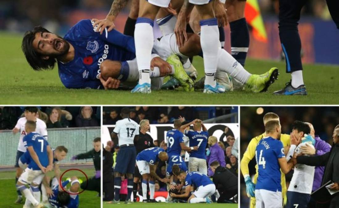 Las imágenes de la terrible lesión que le provocó Heung-Min Son, surcoreano del Tottenham, al mediocampista portugués del Everton, André Gomes, en partido de la Premier League.
