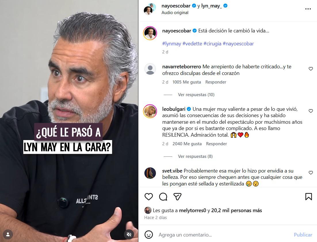 Triste testimonio: Lyn May revela por qué se deformó su rostro