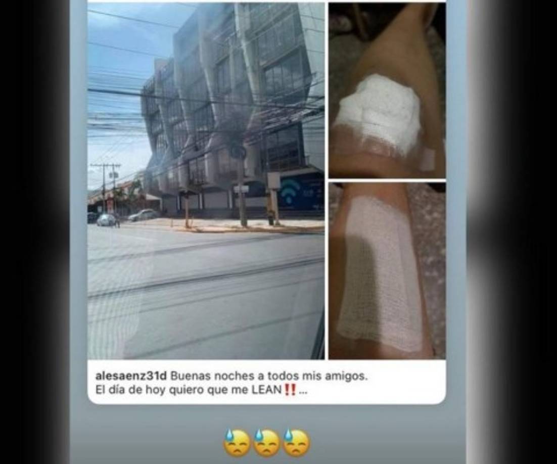 Compartió fotografías del golpe que sufrió en el hecho y el sitio donde ocurrió a través de sus redes sociales.